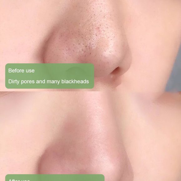 Clay Mask Stick Anti-Acne Deep Cleansing Pores(Green Tea) - Picture 10 of 14